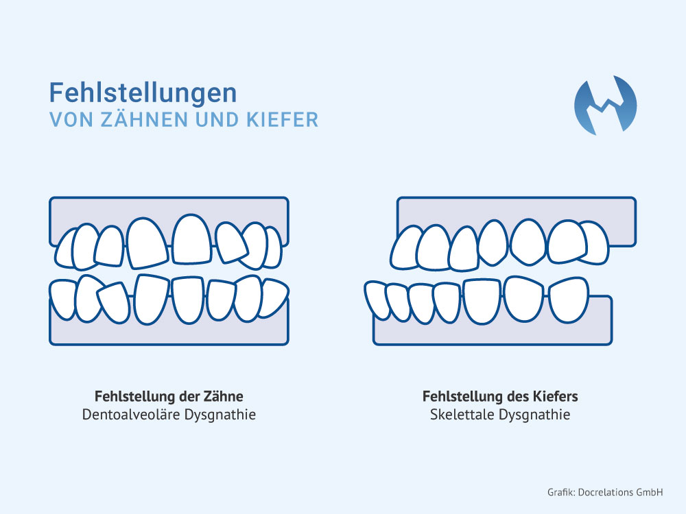 Behandlung Zahnfehlstellungen Mönchengladbach